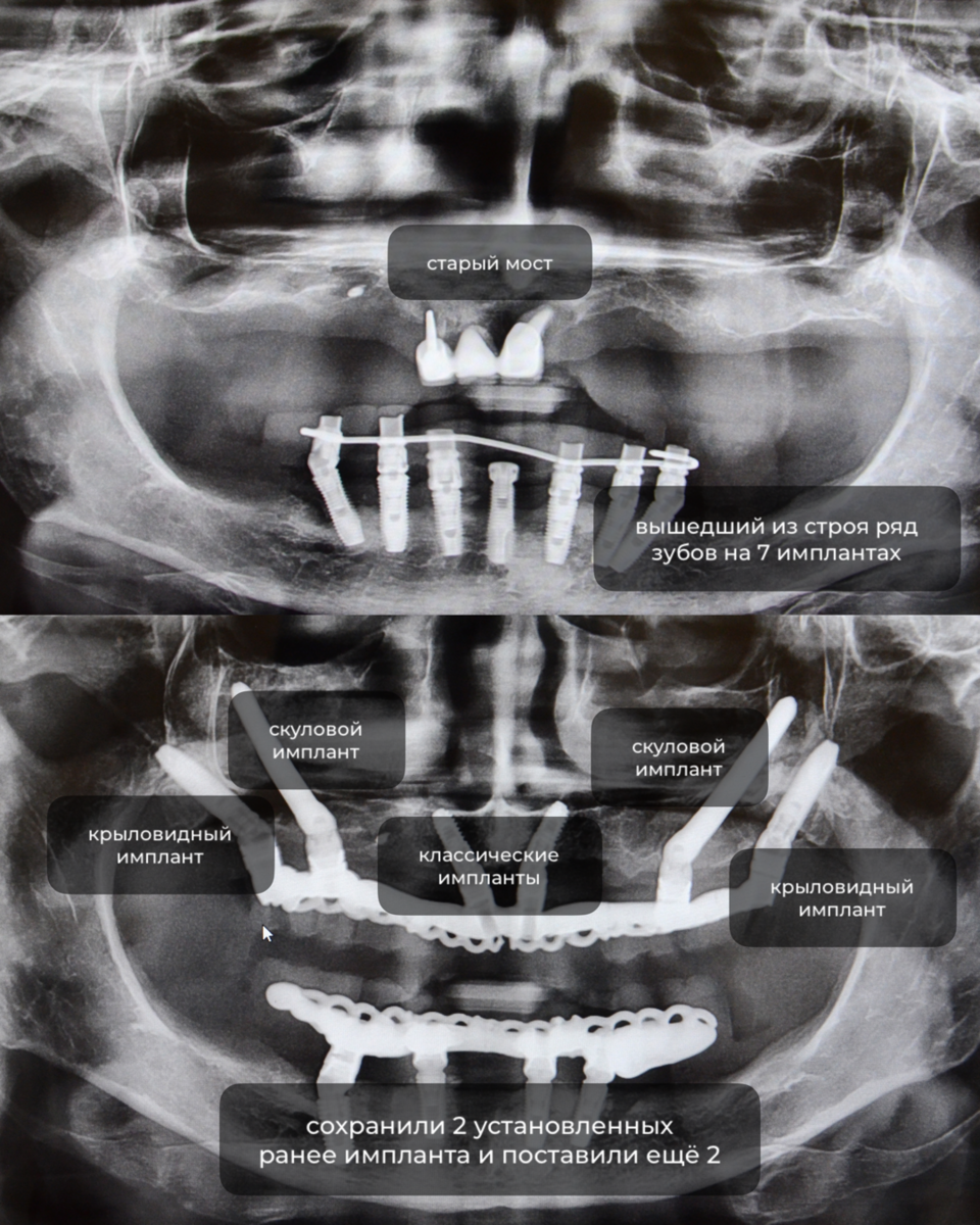 до и после на снимке