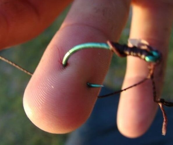 Фото из интернета. Крючок вонзился в палец.