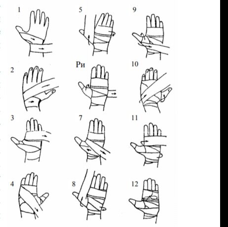 Как правильно намотать бинты