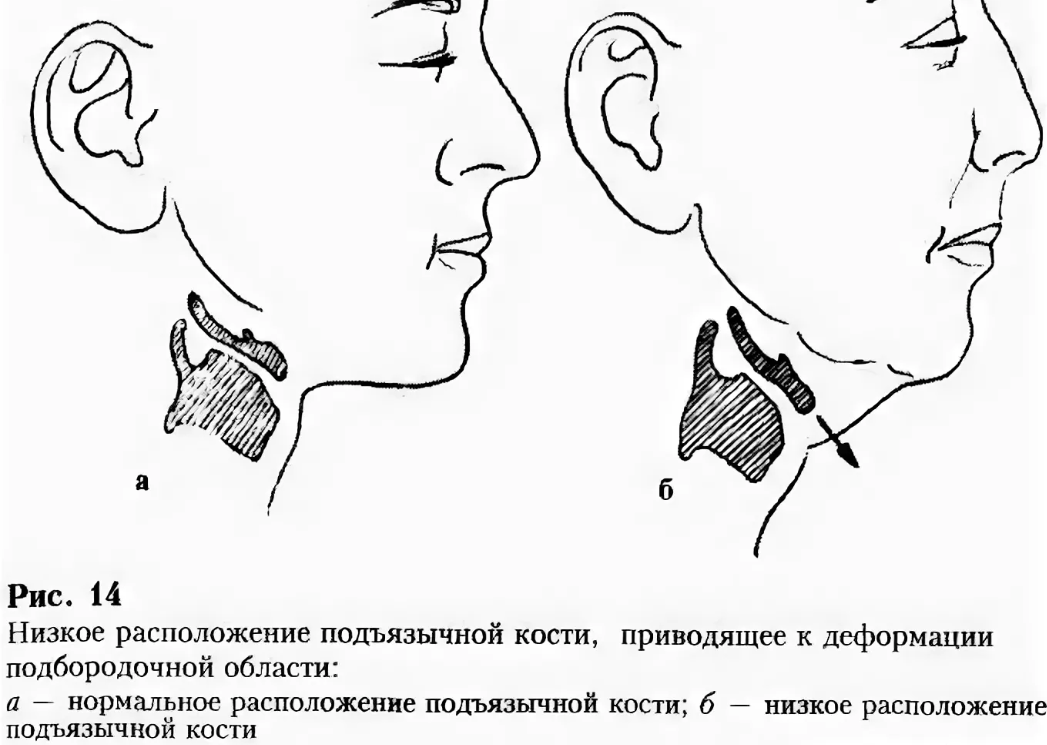 Низкое положение подъязычной кости. Расположение подъязычной кости. Положение подъязычной кости. Подъязычная кость расположение.