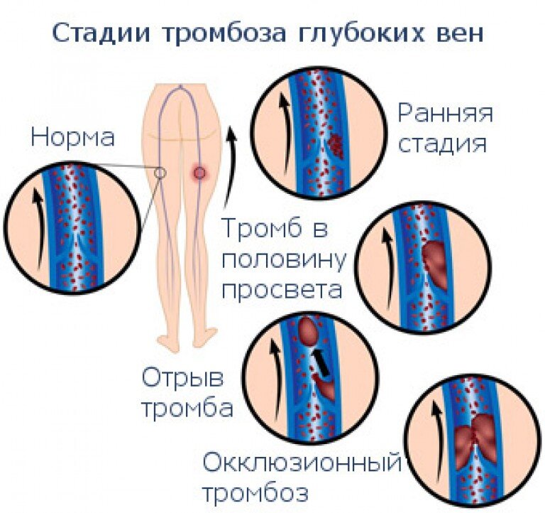 Цены отделения флебологии