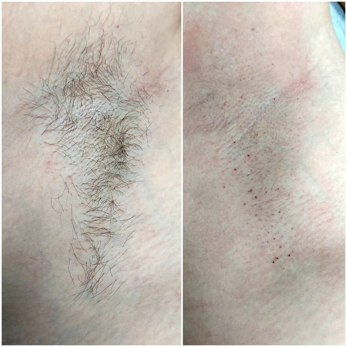 "Кровяная роса"