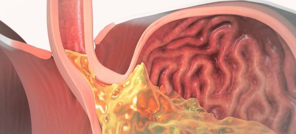 Источник: https://yandex.ru/images/