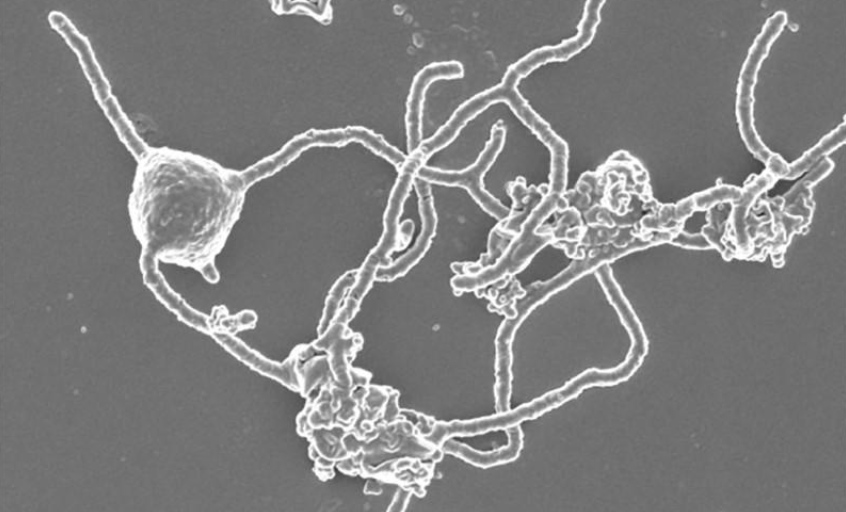 Изображение, полученное с помощью сканирующей электронной микроскопии одноклеточного организма, штамма Prometheoarchaeum syntrophicum MK-D1