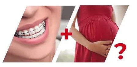 Яндекс картинки