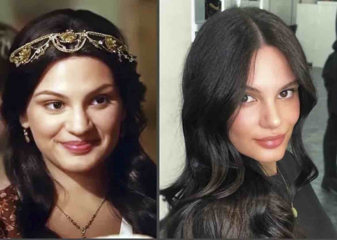 турецкие актрисы до и после пластики. турецкие актрисы до и после пластики. бирдже акалай до пластики. турецкие актрисы до и после пластики. турецкие актрисы до и после пластики.