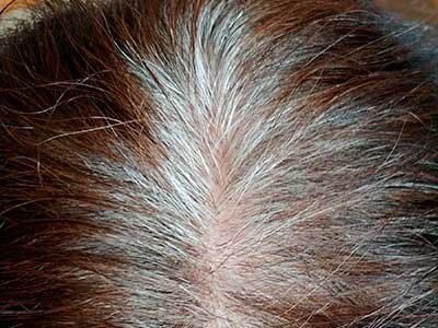 Седые корни (собст.фото)