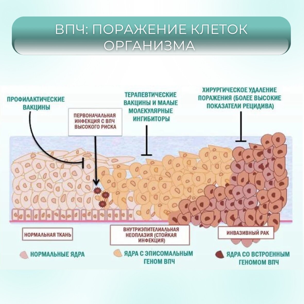 Днк вирус папилломы человека впч