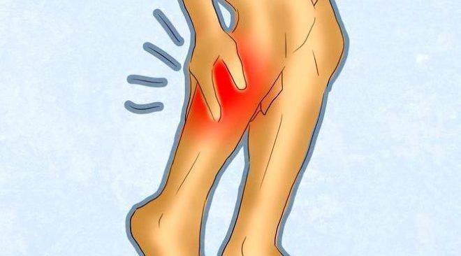 Боль при ходьбе, перемежающаяся хромота.