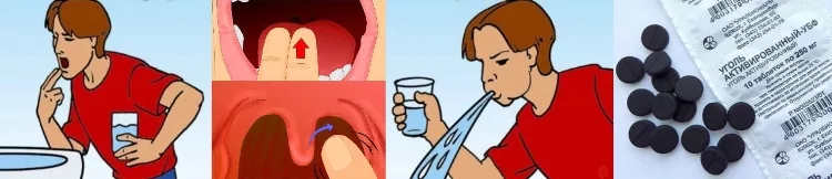 Отравление через рот. При отравлении через рот:. Промывание пострадавшему желудка. Глотать кровь можно