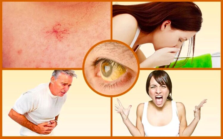 Как распознать коронавирус