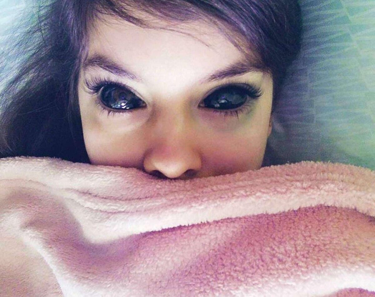 Тома ослепла. Тома ослепла. Тома ослепла. Люди с чёрными белками глаз. Пирсенг глазного яблоко.