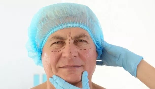 К пластическому хирургу мужчины часто обращаются, чтобы убрать мешки под глазами