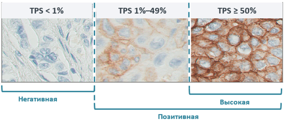 механизмы онкогенной трансформации клеток вирусами. экспрессия в опухолевых клетках что это. экспрессия в опухолевых клетках что это. иммуногистохимическая реакция. дисбаланс в опухолевых клетках.
