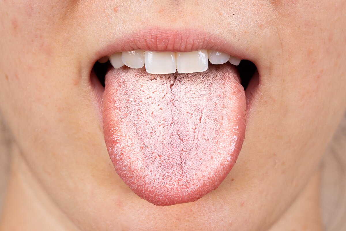Опасен ли оральный секс для здоровья полости рта