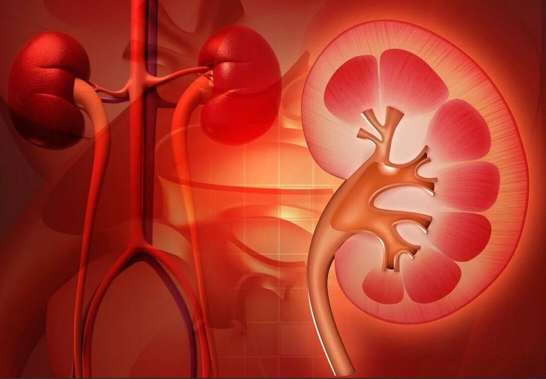 ПМР.ПМЛР (пузырно-мочеточниковый рефлюкс)