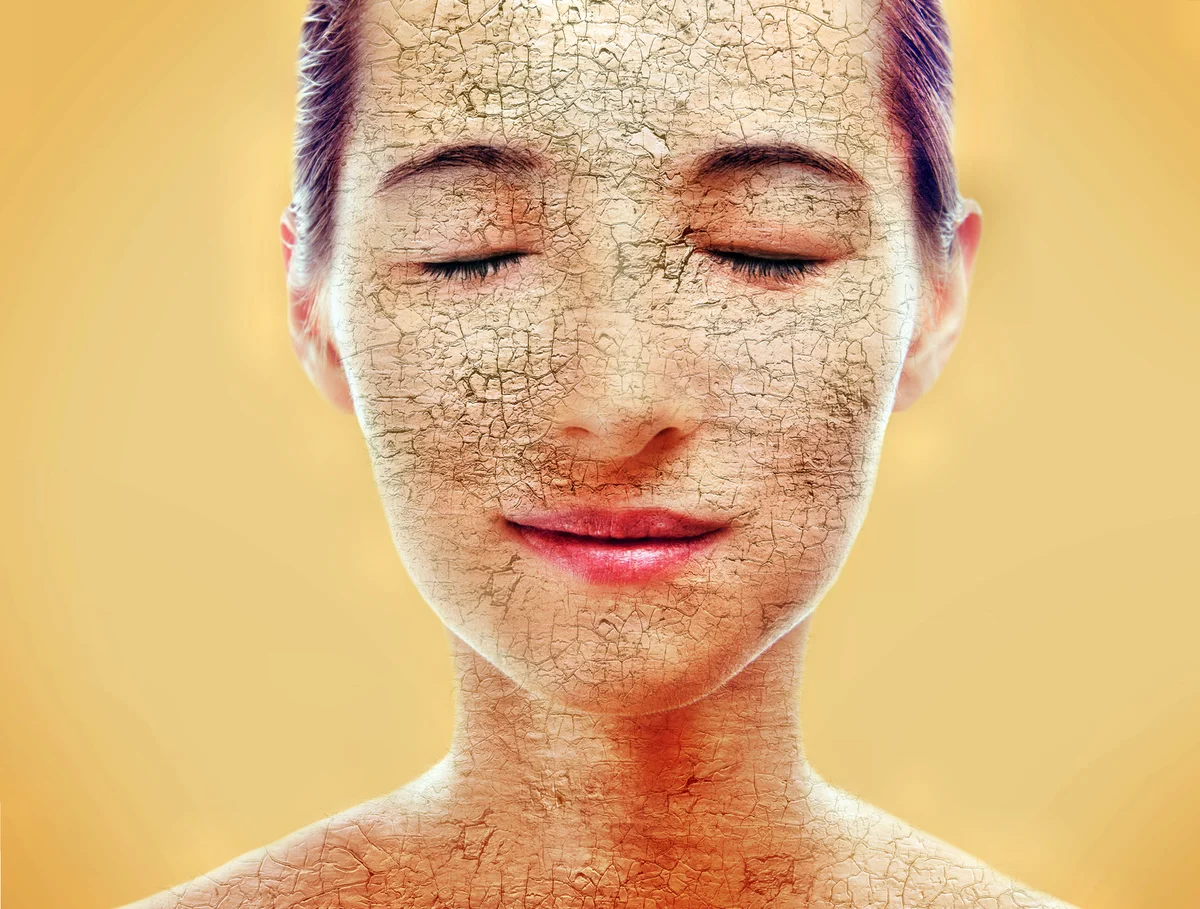 Сухая кожа у диабетиков.