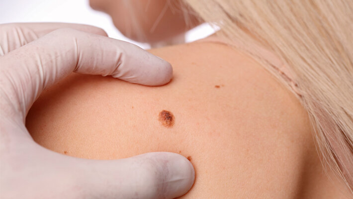 Фото с сайта: medcentrservis.ru