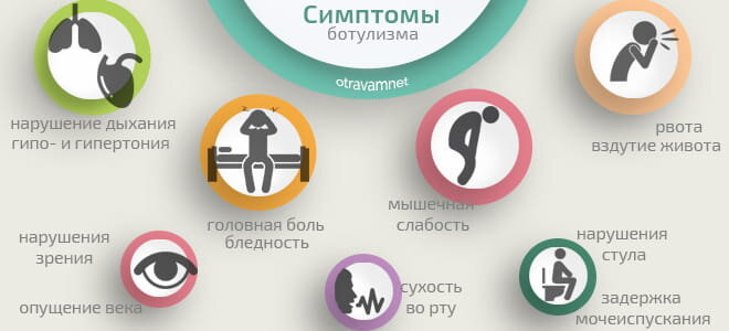 Как понять что ботулизм. Памятка по профилактике ботулизма. Ботулизм профилактика заболевания. Симптомы ботулизм отравления. Клинические формы ботулизма.