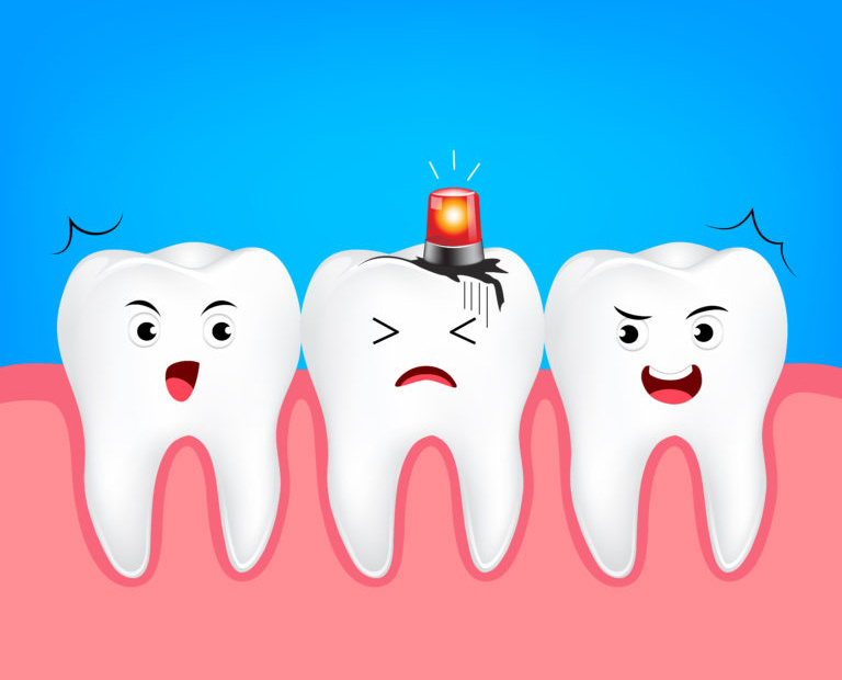 Источник картинки https://www.southbeachsmiles.com