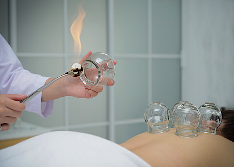 Так, при помощи огня, ставят традиционные стеклянные банки.