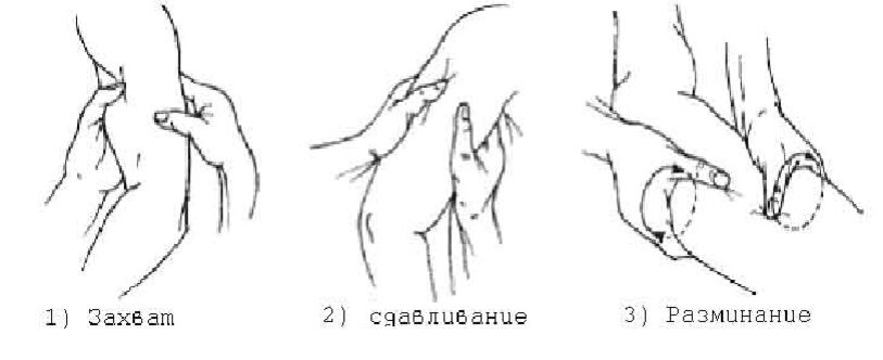Продольное разминание
