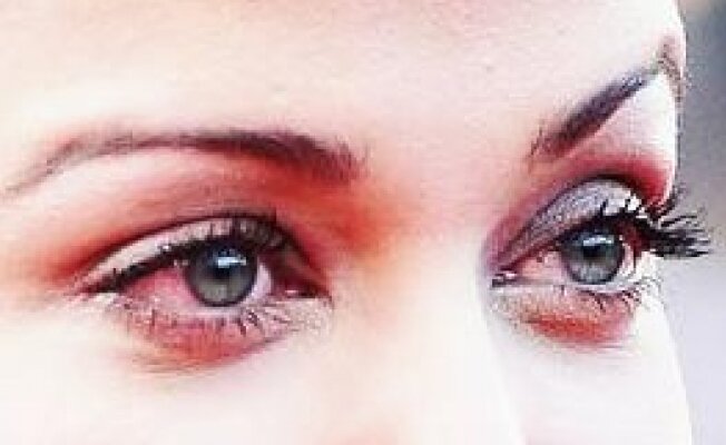 Красные глаза