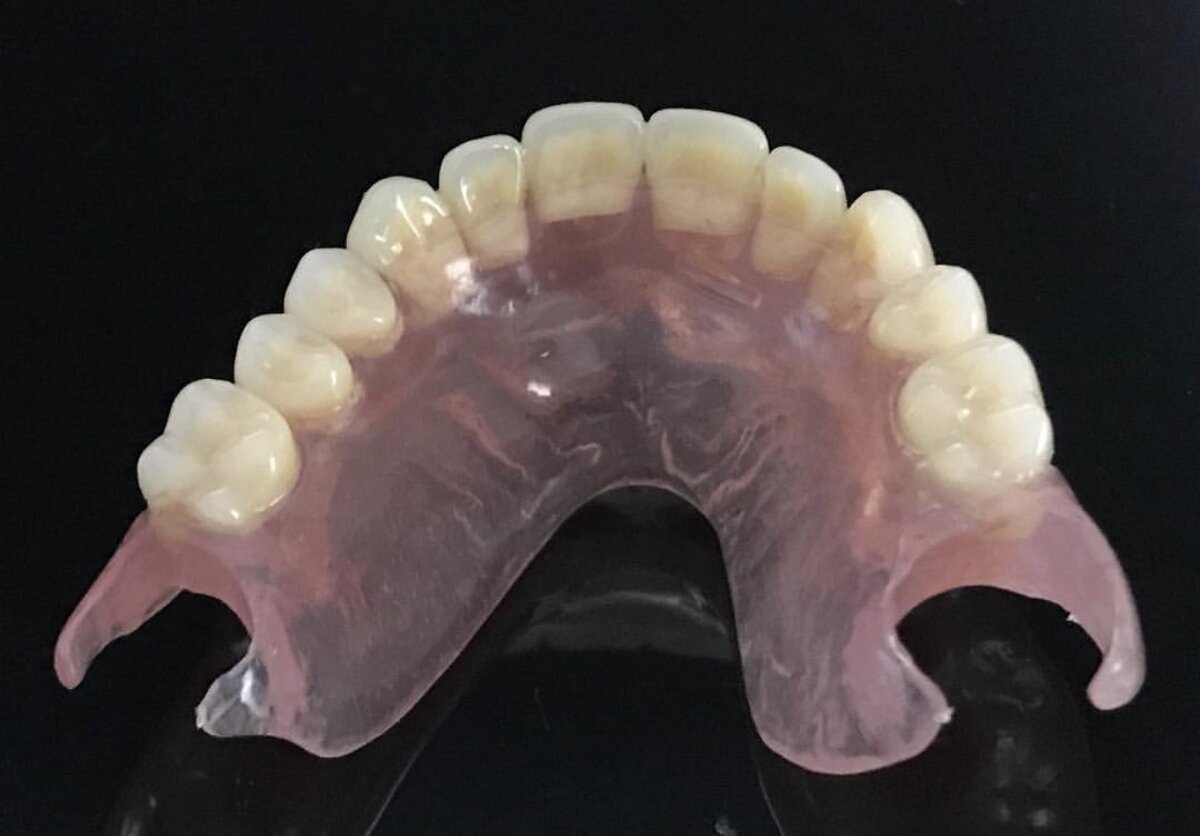 Протезы quattro ti квадротти. Пластиночные зубные протезы. Нейлоновая челюсть отзывы. Нейлоновая челюсть отзывы. Нейлоновый бюгельный протез (квадротти).