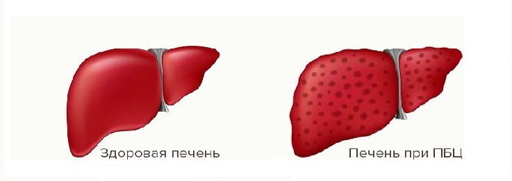 печень 