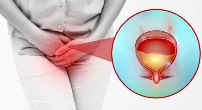 недержание мочи 