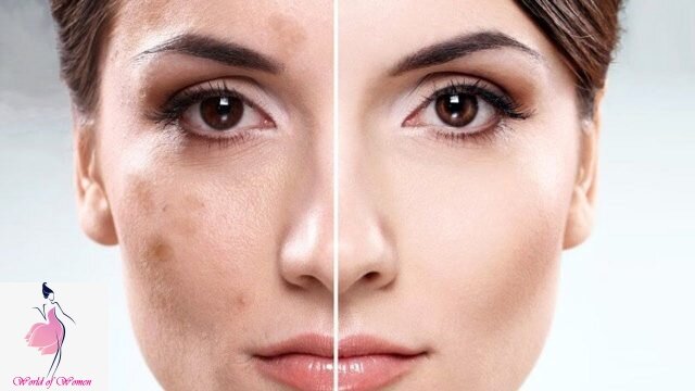 Забота о коже лица: простейшие отбеливающие маски