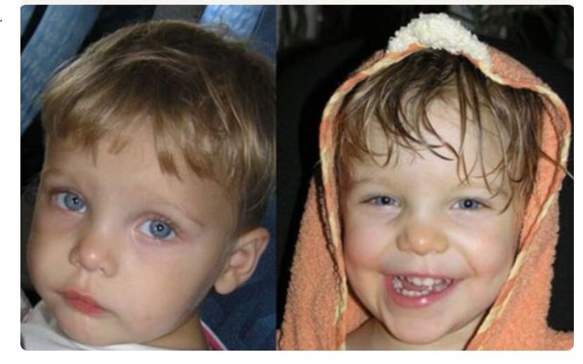 Дети до и после детдома. Детки до и после усыновления. Детки после эко. Фото детей до и после усыновления. Лет после того как ребенок.