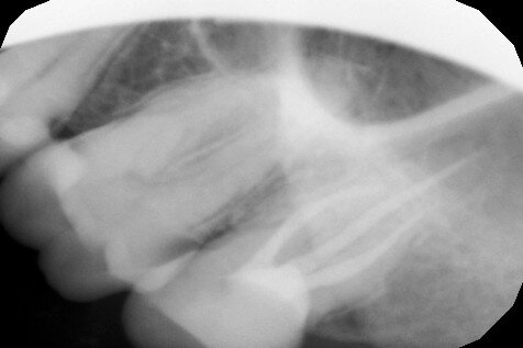 Мой зубик)))