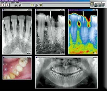 Цифровые снимки на экране монитора