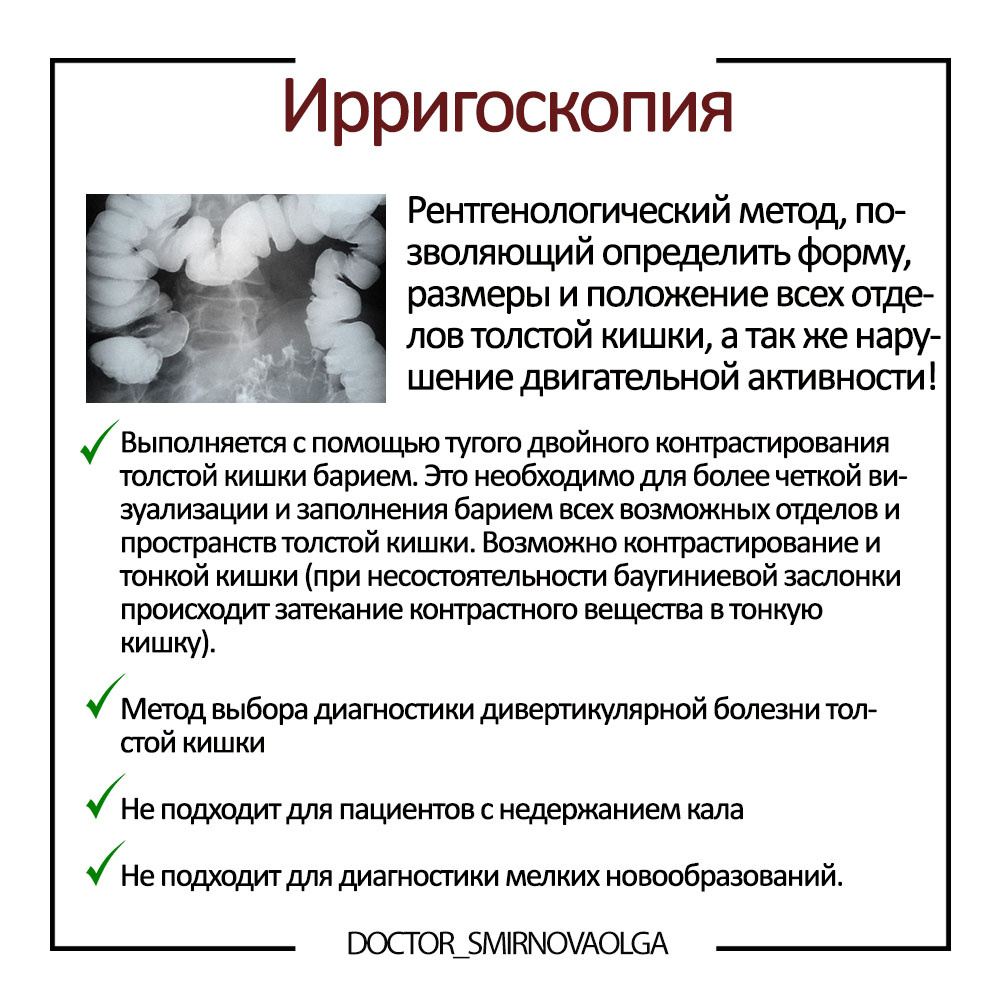 Ирригоскопия