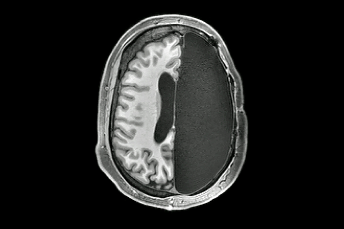 Источник: Caltech Brain Imaging Center и NYT