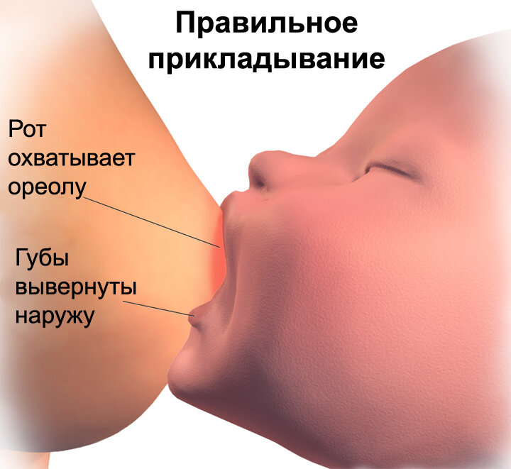 Втянутый сосок и его хирургическая коррекция