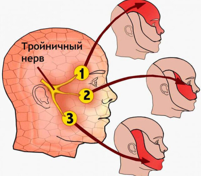 Невралгия у взрослых: симптомы, причины, лечение