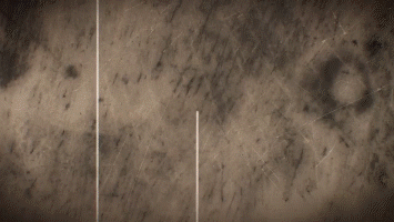 Последствия облучения