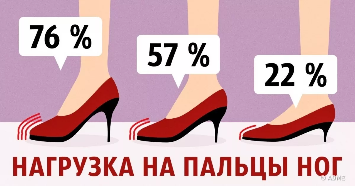 Как избежать проблем со стопами?