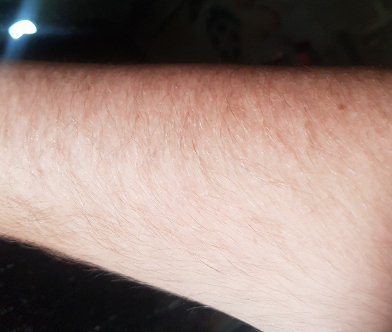 Рука супруга для иллюстрации волос. Личная фотография. 