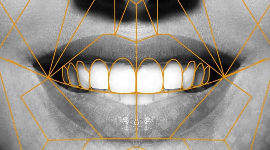 Задача стоматолога, работающего по принципам Anti-Age, – не только восстановить зубы (их форму и эстетику), но и учесть при этом стандарты красоты. Фото: Smile-at-Once.ru.