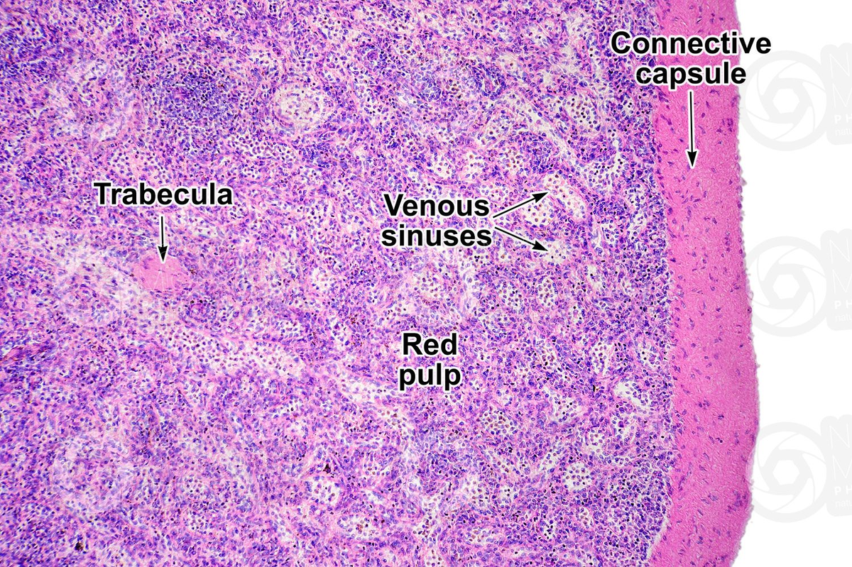Селезенка под микроскопом. В красной пульпе задерживается кровь