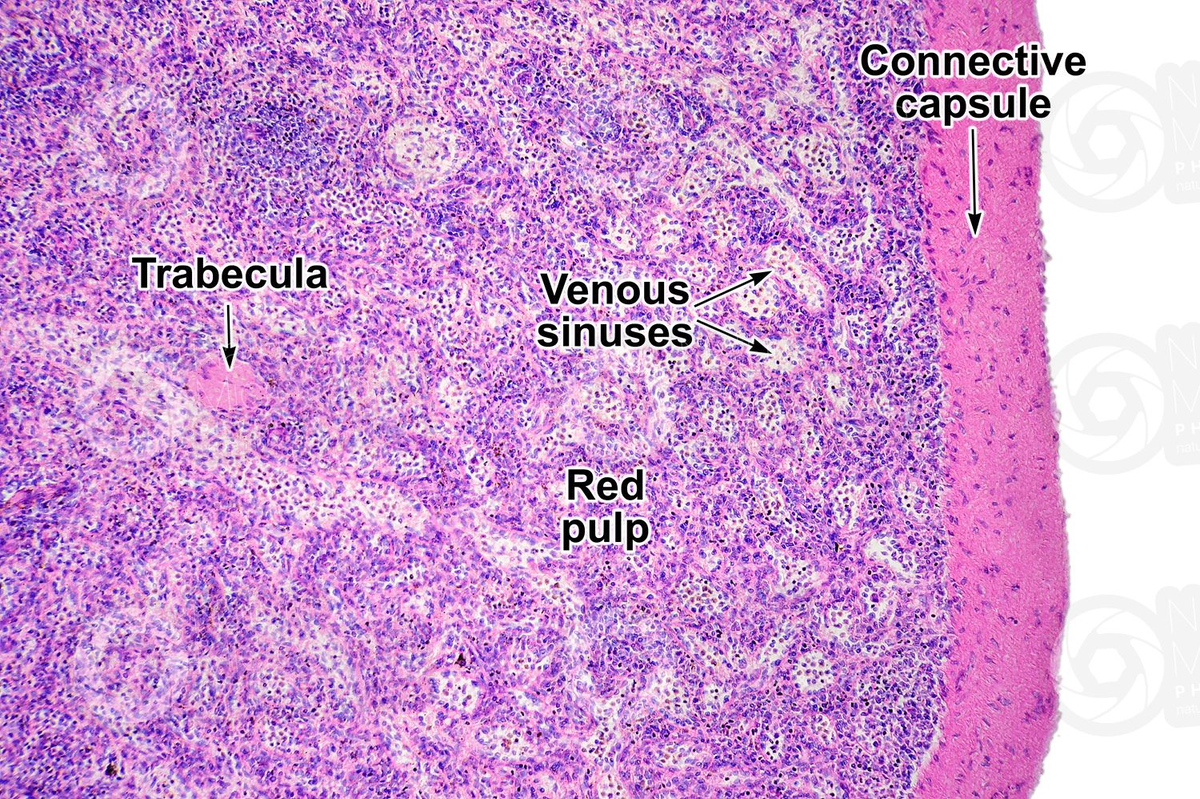 Красная пульпа селезенки. Белая пульпа селезенки гистология. Селезенка гистологический препарат. Красная пульпа селезенки гистология. Трабекулярная Вена селезенки гистология.