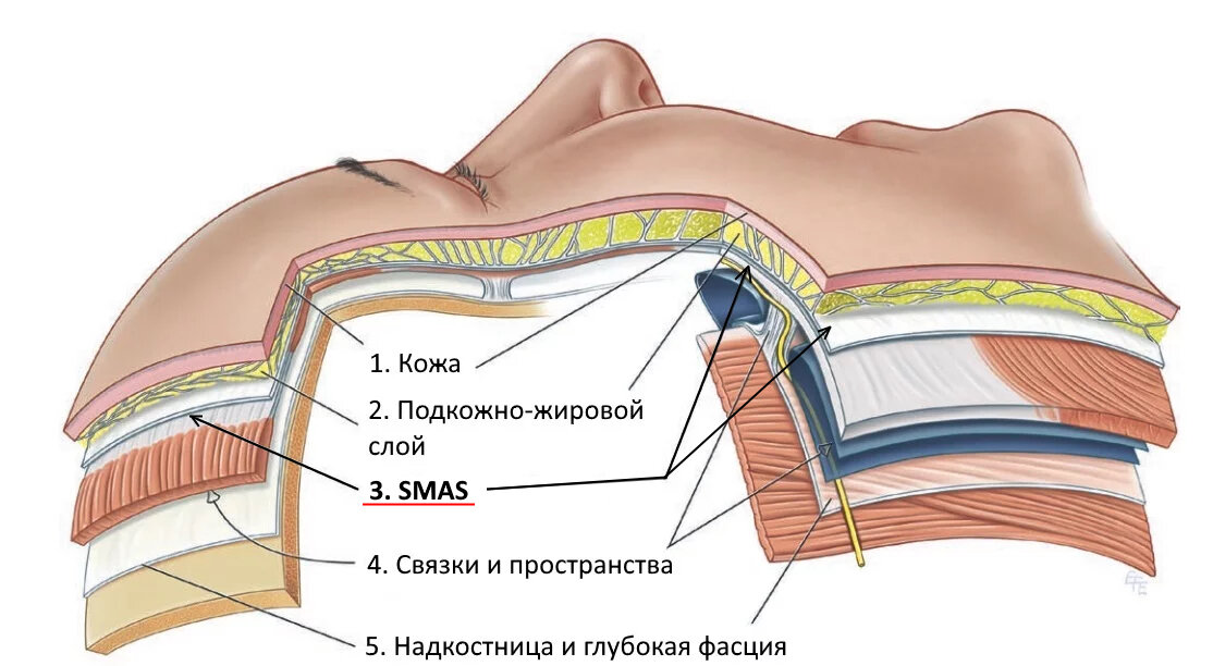 Мягкие ткани тела. Послойное строение мягких тканей лица. Брайан Мендельсон анатомия. Мышечно апоневротический слой лица. Смас слой кожи.