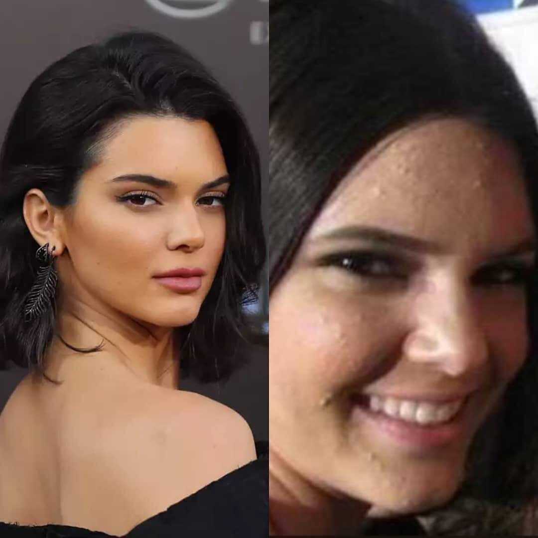 Кендалл  Дженнер  до после