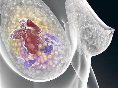 молочные железы 