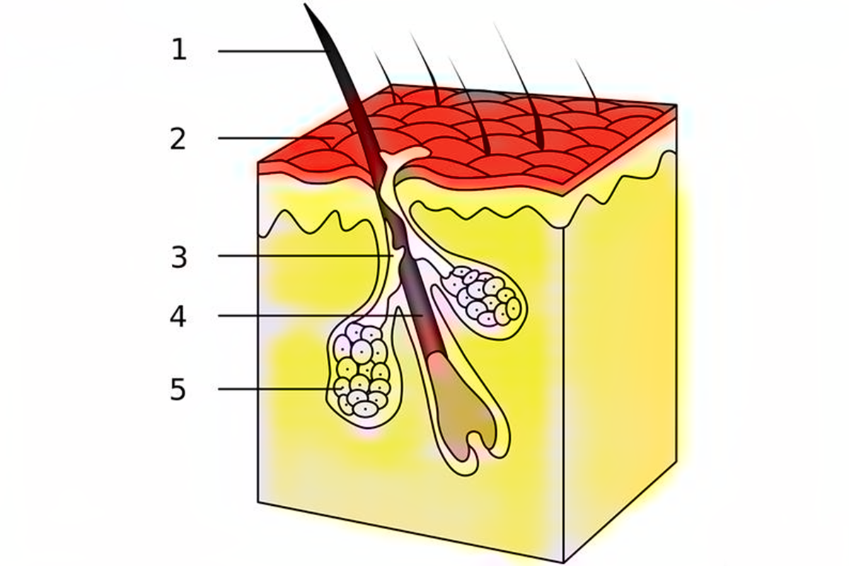 Волосок. Устье волосяного фолликула. Волосяная луковица и волосяной фолликул. Строение волосяной луковицы. Сально волосяной фолликул.