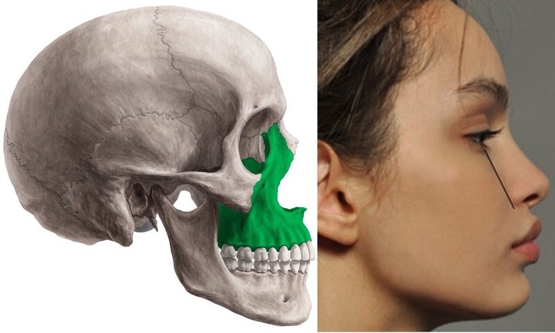 На фото зеленым отмечена максилла. Источник: https://zub-za-zub.ru/beauty/maxilla/