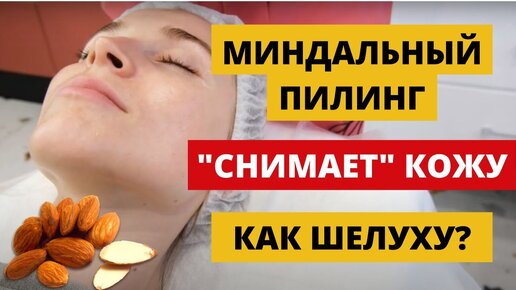 Что такое миндальный пилинг для лица?